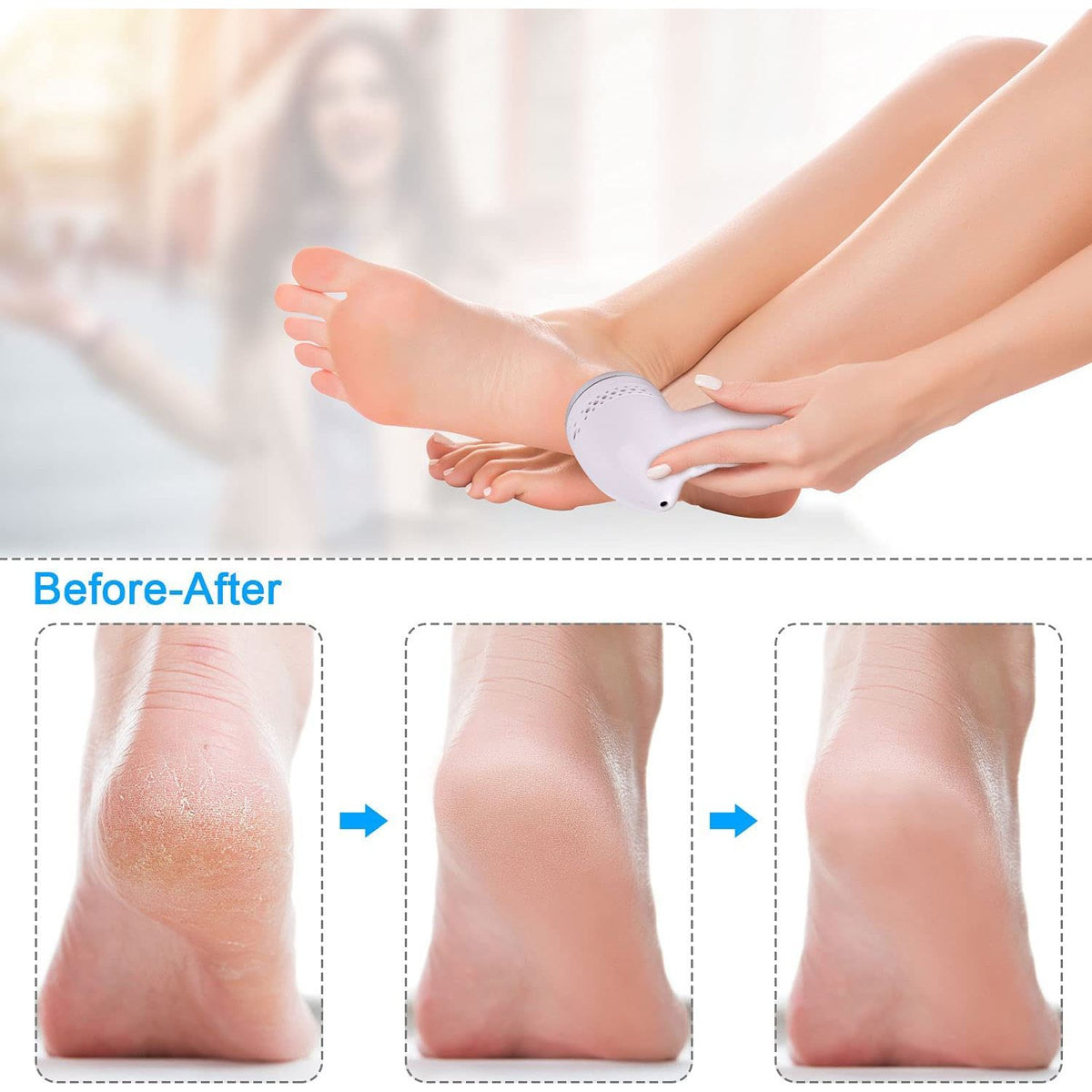 Portable Electric Callus Grinder - 4msproducts